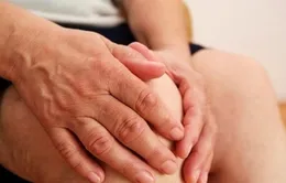 Điều trị bệnh khớp thời điểm giao mùa