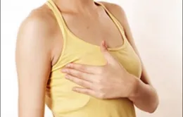 Ung thư vú và 7 điều nên biết
