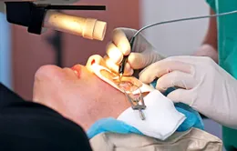 Tiến bộ vượt bậc trong kỹ thuật Lasik trị tật khúc xạ