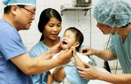 10 năm Việt - Hàn hợp tác phẫu thuật khe hở môi, vòm miệng 