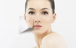 BB cream có cần thiết hay không?