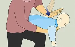 Bé bị hóc thạch - Làm sao đây?