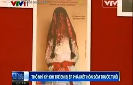 Thổ Nhĩ Kỳ: Nhức nhối nạn tảo hôn giữa thế kỷ 21