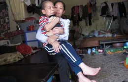 Xót thương em nhỏ bị bại liệt, bại não