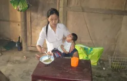 Xót xa cậu bé 2 tuổi não nhỏ, sống như thực vật
