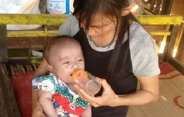 Chương trình TTCE trợ giúp bé Thái Bá Quân phẫu thuật tim