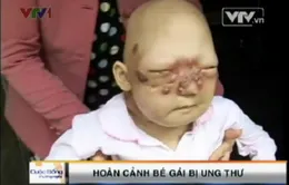 “Mong sao con mở được mắt để nhìn thấy mẹ”!