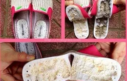 Dép chứa "chất lạ" gây ngứa rát và tê chân