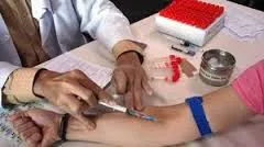 Hôm nay (28/7), ngày Thế giới phòng chống viêm gan 