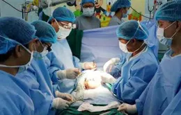 Phẫu thuật thành công cặp song sinh dính liền Long - Phụng 