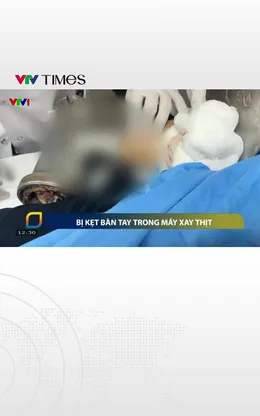 Bị kẹt bàn tay trong máy xay thịt