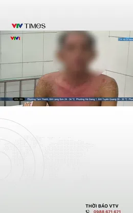 Cứu người dị ứng nghiêm trọng với thuốc nhỏ mắt