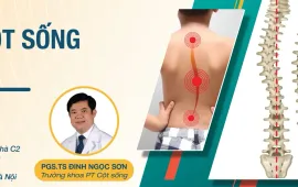 Khám sàng lọc, tư vấn miễn phí gù vẹo cột sống ở trẻ em