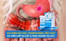 Cải thiện đầy hơi, chướng bụng khi mắc viêm dạ dày, trào ngược dạ dày thực quản