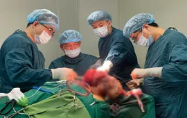 Quảng Bình: Phẫu thuật thành công khối u dị dạng mạch máu hiếm gặp vùng mặt