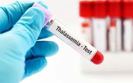 Ngày Thalassemia Thế giới 2025: Chung tay vì một thế hệ khỏe mạnh