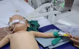 5 trẻ suýt ngạt vì hóc dị vật: Cha mẹ cần biết cách sơ cứu đúng