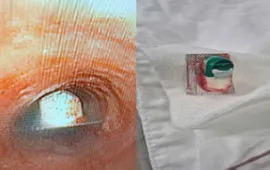 Hóc vỏ thuốc chưa bóc: Cảnh báo tai nạn đường thở nguy hiểm