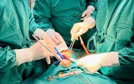 Sưng đau vùng hàm kéo dài - đừng chỉ nghĩ do răng miệng