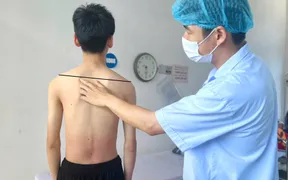 Vietnam performs first scoliosis surgery using vertebral body tethering