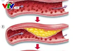 Chất lượng cuộc sống 