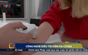 Công nghệ điều trị viêm da cơ địa