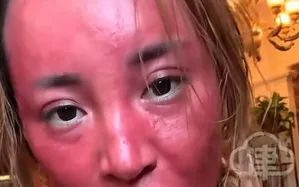 Không tẩy trang suốt 22 năm, gương mặt người phụ nữ Trung Quốc biến dạng đáng sợ