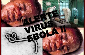 Đại dịch Ebola