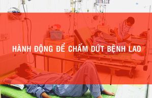 Hành động để chấm dứt bệnh lao