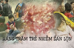 Hàng trăm trẻ nhiễm sán lợn