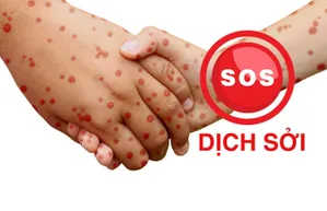 SOS - Dịch sởi