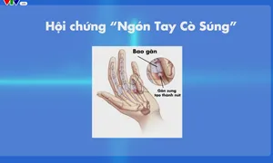 "Khỏe - Vui: Ngón tay cò súng" (20h55, thứ Bảy, 27/1)