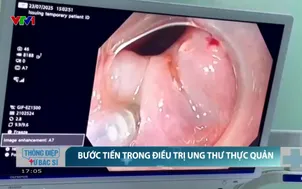 Bước tiến trong điều trị ung thư thực quản