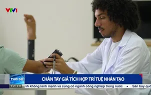 Chân tay giả tích hợp trí tuệ nhân tạo