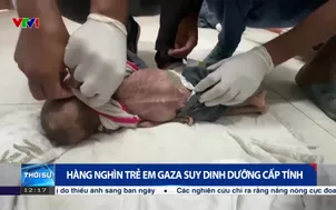 Hàng nghìn trẻ em Gaza suy dinh dưỡng cấp tính