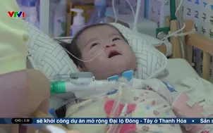 Cứu sống trẻ sơ sinh tim nằm ngoài lồng ngực