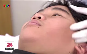 Gia tăng bệnh nhân liệt dây thần kinh số 7 ngoại biên do nhiễm lạnh