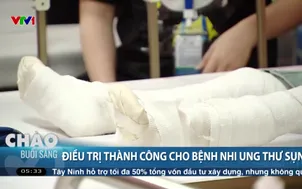Điều trị thành công cho bệnh nhi ung thư sụn