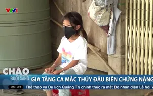 Gia tăng ca mắc thủy đậu biến chứng nặng