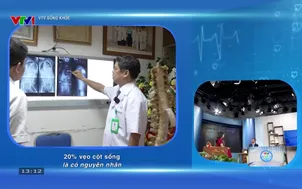 VTV Sống khỏe: Cảnh báo cong vẹo cột sống