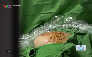 VTV Sống khỏe: Hành trình răng xinh