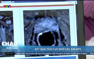 Kết quả tích cực nhờ vắc xin HPV