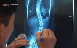 	VTV Sống khỏe: 	Hành trình cùng con vững bước