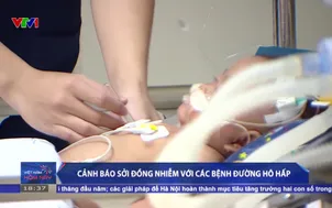 Cảnh báo sởi đồng nhiễm với các bệnh đường hô hấp