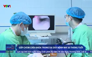 Gắp chùm chìa khóa trong dạ dày bệnh nhi 30 tháng tuổi