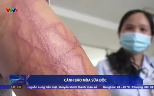 Cảnh báo mùa sứa độc