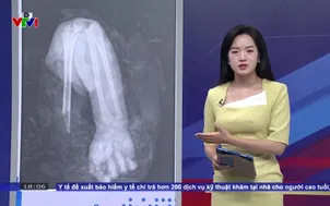 Hiểm họa do bất cẩn khi dùng áo chống nắng