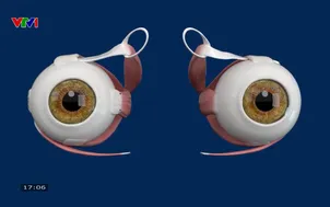 Nguyên nhân và cách điều trị bệnh lý lác