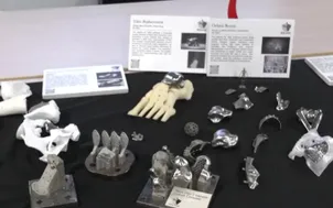AI tái tạo xương 3D