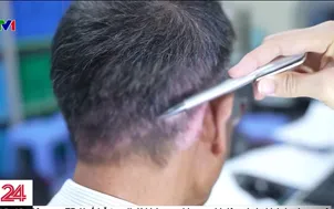 Không chủ quan với bệnh vảy nến